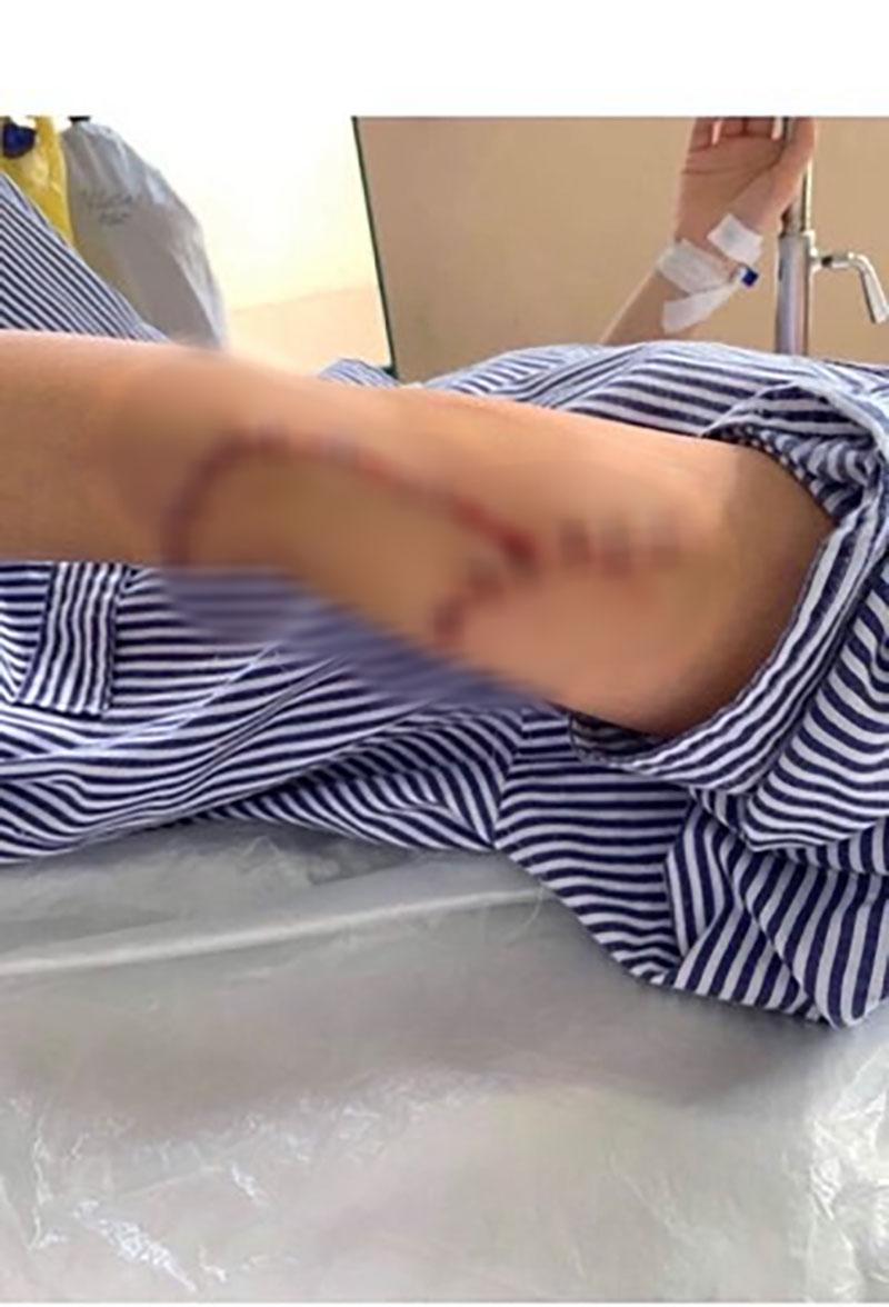 Lời trần tình đẫm nước mắt của cô gái rạch mặt bạn cũ phải khâu 60 mũi: Sao mọi người chỉ bênh cô ấy mà mạt sát tôi?-2