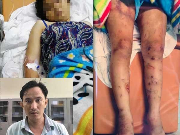 Lời khai của 2 anh em chủ mưu vụ tra tấn khiến bà bầu sinh non, thai nhi tử vong ở Sài Gòn-3