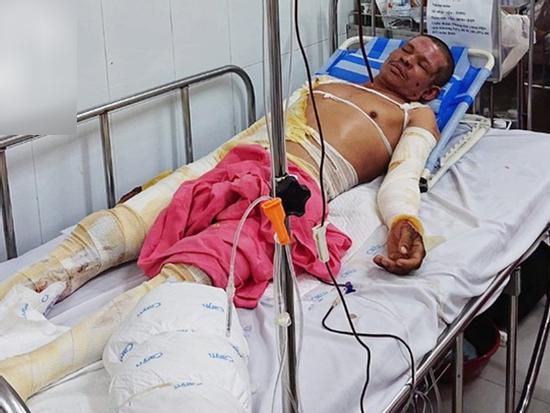 Chiết xăng xe để đi làm nuôi vợ con, người đàn ông bị bốc cháy, hóa thành 'ngọn đuốc sống'