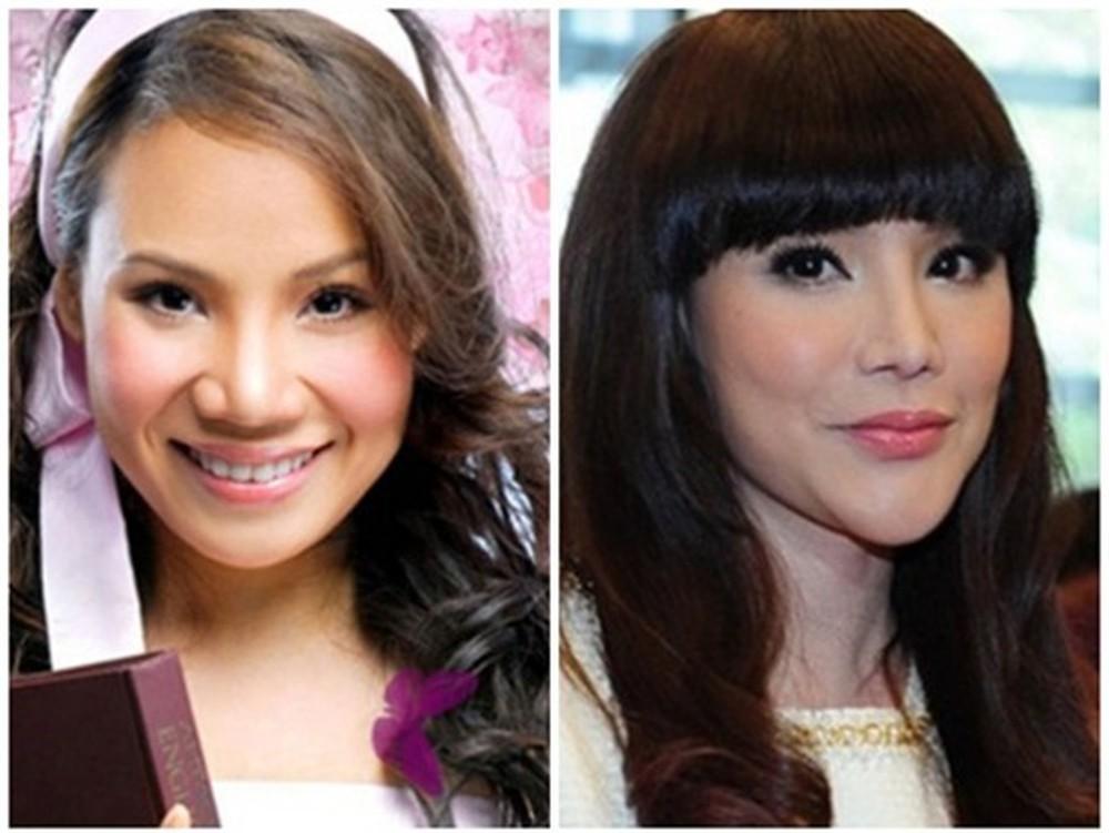 Bác tin đại phẫu dao kéo, Hồ Quỳnh Hương cho biết thủ phạm khiến gương mặt phù nề đáng sợ năm xưa chính là kem trộn-1