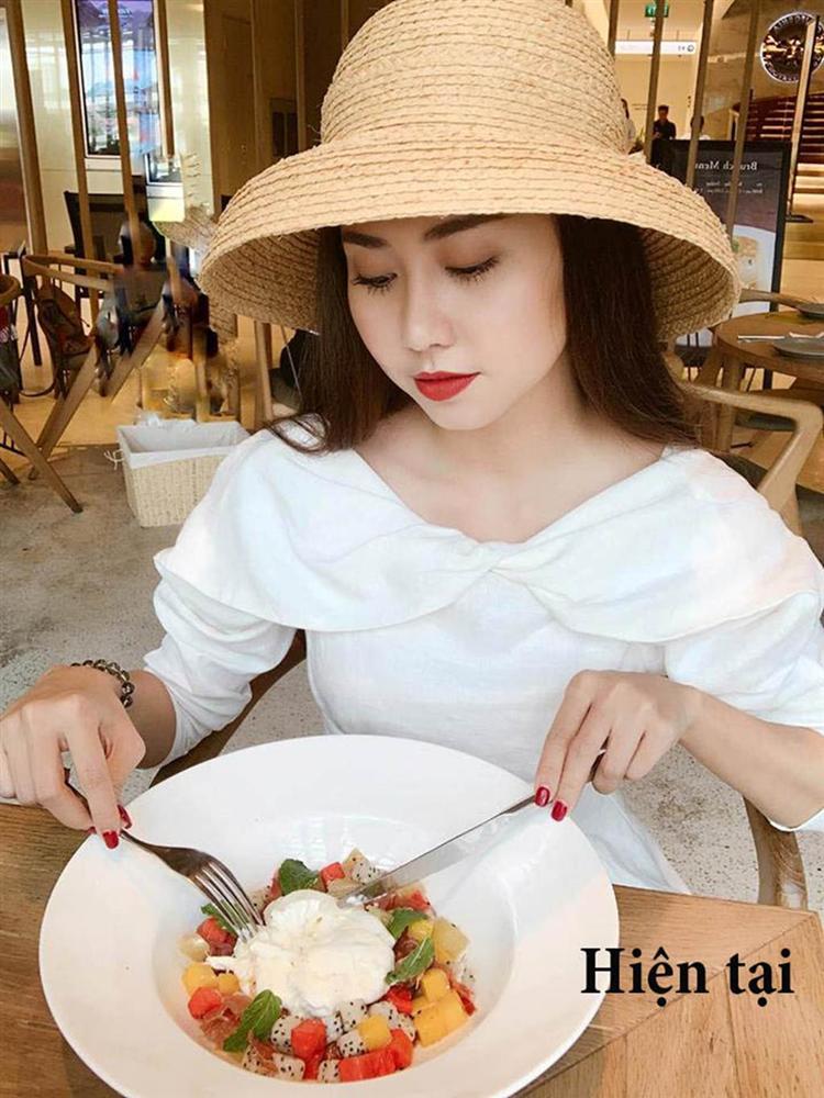 Phi Thanh Vân, Lệ Quyên, Ngân 98... gặp sự cố vì sửa mũi-3