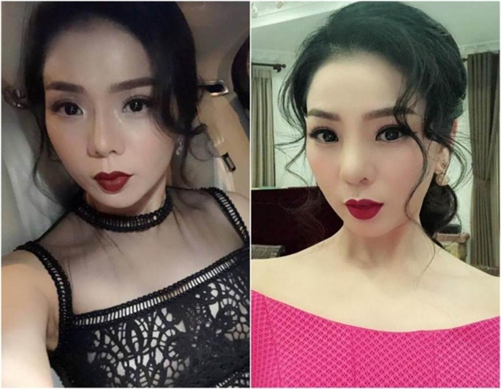 Phi Thanh Vân, Lệ Quyên, Ngân 98... gặp sự cố vì sửa mũi-5