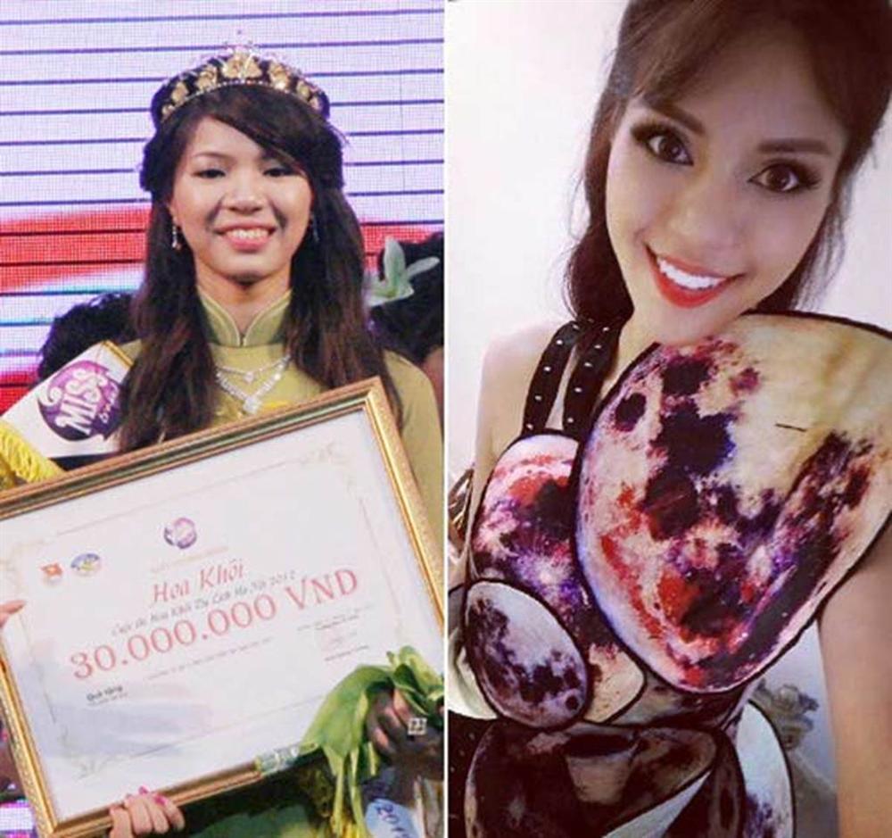 Phi Thanh Vân, Lệ Quyên, Ngân 98... gặp sự cố vì sửa mũi-9