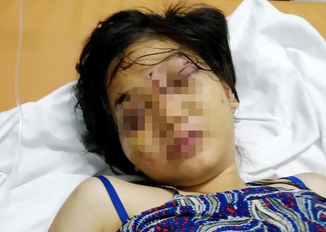 Lời khai của nhóm người tra tấn khiến cô gái 18 tuổi sẩy thai-1