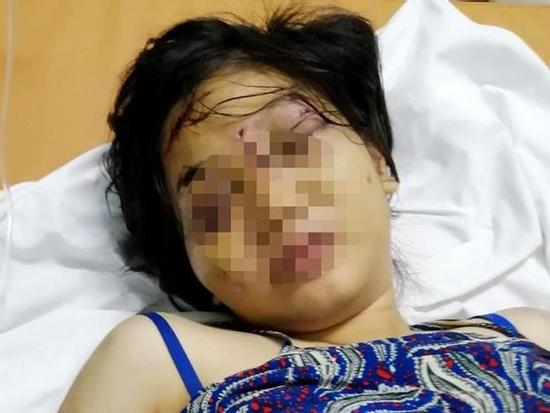 Lời khai của nhóm người tra tấn khiến cô gái 18 tuổi sẩy thai