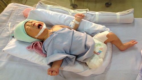Bị văng ra khỏi bụng mẹ, mất một chân sau vụ tai nạn thảm khốc, thai nhi ở An Giang thay đổi ra sao sau 3 năm?-1