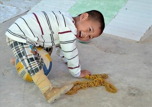 Bị văng ra khỏi bụng mẹ, mất một chân sau vụ tai nạn thảm khốc, thai nhi ở An Giang thay đổi ra sao sau 3 năm?-10