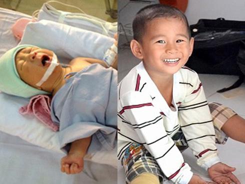 Ngoại hình thay đổi bất ngờ của bé sơ sinh mất chân, bị mẹ bỏ rơi trong vườn hoang sau 13 năm-7