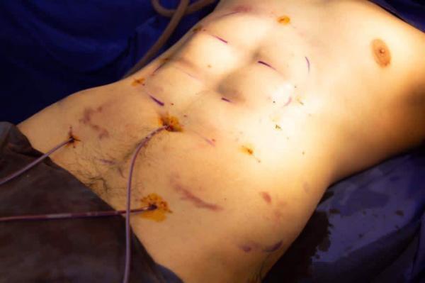 Sự thật về phương pháp tạc cơ bụng sáu múi-1