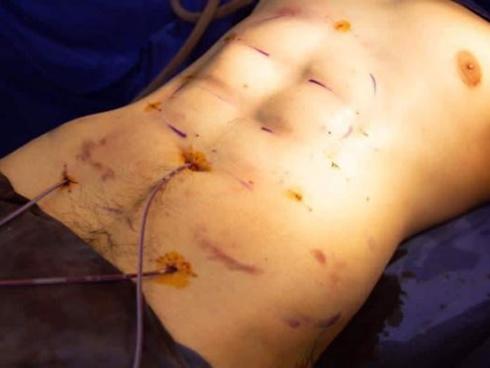 Sự thật về phương pháp 'tạc' cơ bụng sáu múi