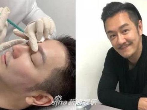 Xuất hiện với diện mạo bọng mắt sưng, đầu mũi to, Trần Hạo Dân phẫu thuật thẩm mỹ thất bại?-9