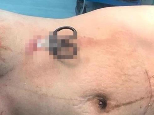 Người đàn ông ở Sài Gòn bất ngờ dùng dao tự đâm vào bụng-2