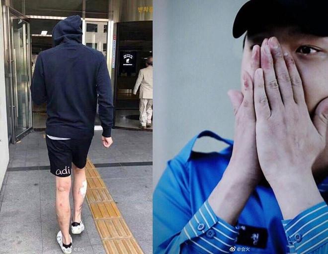 Park Yoochun nhận tội chơi ma túy sau nhiều lần ngoan cố phủ nhận-2