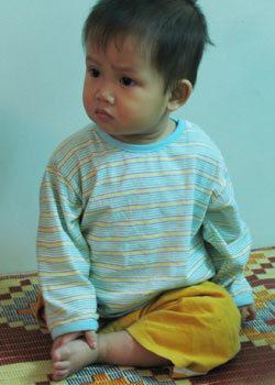 Ngoại hình thay đổi bất ngờ của bé sơ sinh mất chân, bị mẹ bỏ rơi trong vườn hoang sau 13 năm-1