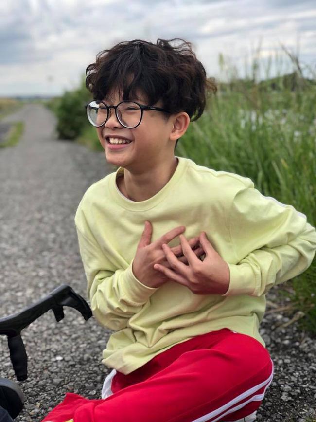 Ngoại hình thay đổi bất ngờ của bé sơ sinh mất chân, bị mẹ bỏ rơi trong vườn hoang sau 13 năm-6