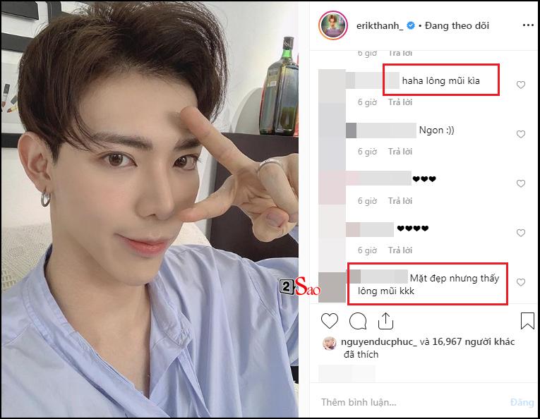 Tự khen đẹp trai ngời ngời sau ồn ào thẩm mỹ, nhưng quá nhọ cho Erik khi gương mặt bị soi điểm bất thường-2