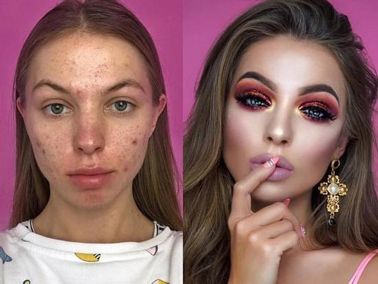 Phép màu không thể biến những cô gái mặt mụn thành nữ hoàng nhưng trang điểm thì có thể