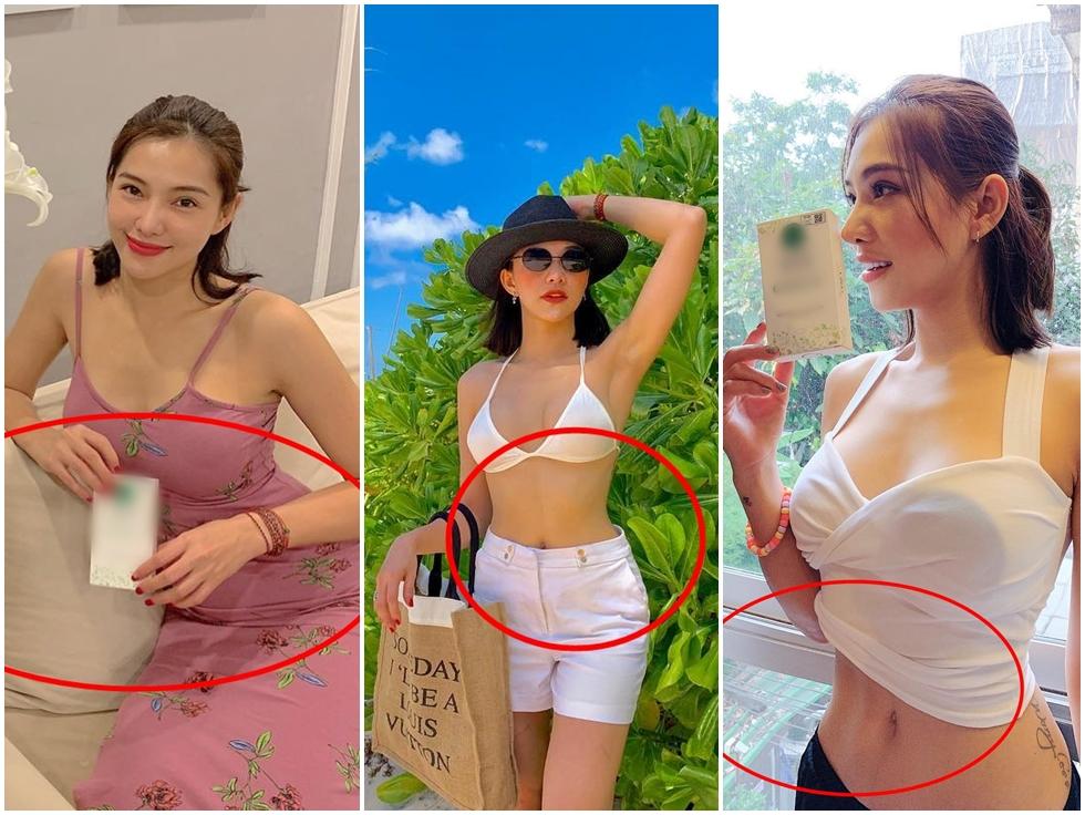 Ngỡ ngàng trước sự lột xác vi diệu nhờ niềng răng, dung mạo thay đổi 180 độ-11