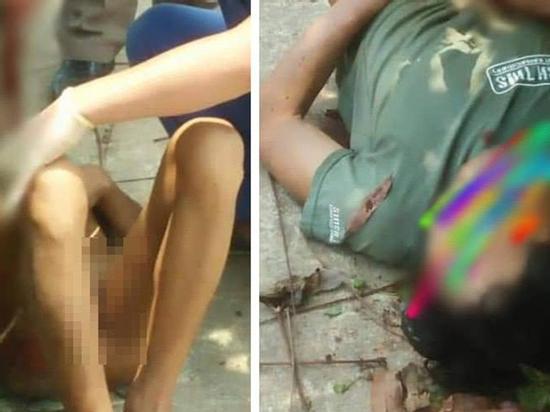 Hà Tĩnh: Người đàn ông tự cầm dao đâm xuyên ruột