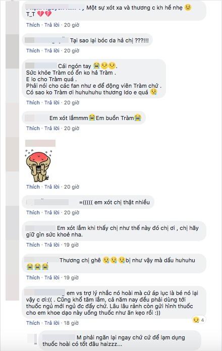 Trước khi dừng hát, Hương Tràm từng trầm cảm nặng: bóc tay tóe máu, dùng thuốc an thần suốt 5 năm-6