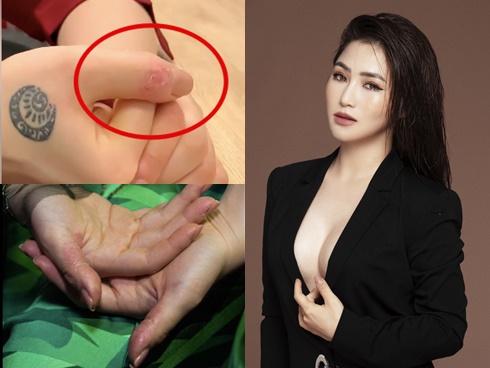 Trước khi dừng hát, Hương Tràm từng trầm cảm nặng: bóc tay tóe máu, dùng thuốc an thần suốt 5 năm