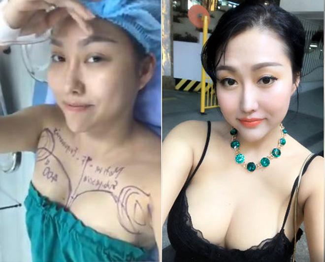 Lý do Kỳ Duyên, Thúy Vi, Vân Hugo và loạt mỹ nhân Việt trùng tu vòng 1-4