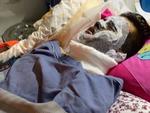 Việt kiều bị tạt axit, cắt gân chân: Công bố điểm nhận dạng 2 nghi phạm