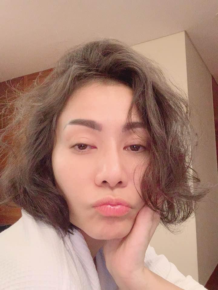 Văn Mai Hương than vãn mệt mỏi vì bị ngã mãi vẫn không hết dấu vết in trên chân-2