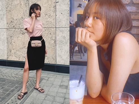 Văn Mai Hương than vãn mệt mỏi vì bị ngã mãi vẫn không hết dấu vết in trên chân