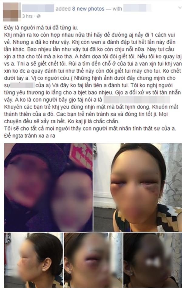 Sốc trước ảnh cô dâu bị đánh bầm tím mặt vì từ chối hôn chồng trong đám cưới và sự thật nhiều người ngã ngửa-4