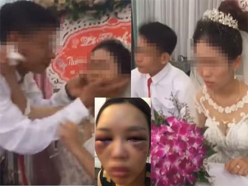 Xôn xao ảnh cô dâu bị đánh vì từ chối hôn chồng ở đám cưới - 2sao