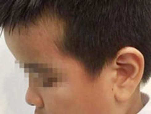 Phụ huynh giận sôi máu trước clip cô giáo tát tới tấp, dùng thước đánh nhiều học sinh lớp 2 trong phòng thi-1