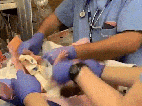 Clip sốc: 1 phút bất cẩn, bác sĩ tuột tay đánh rơi bé gái sinh non khiến bé bị xuất huyết não?
