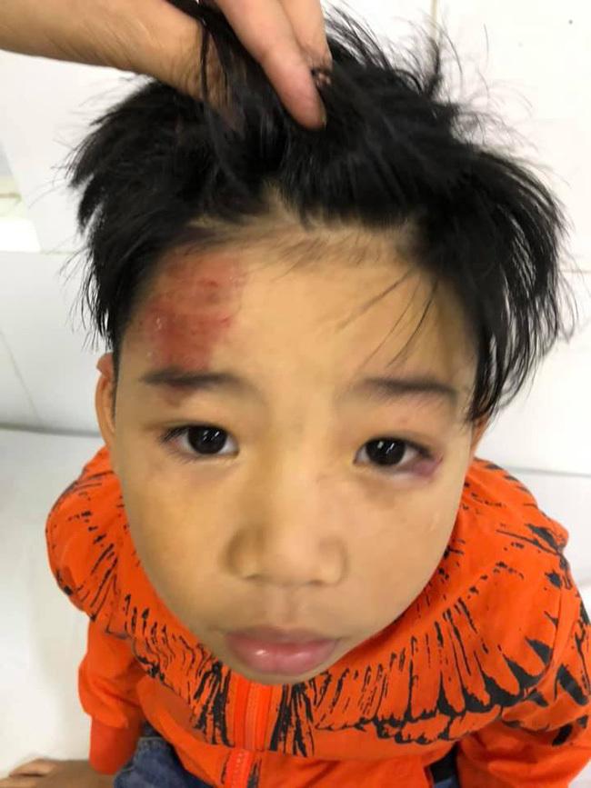 Người mẫu Hạ Vy bàng hoàng khi hai con nhỏ bị ô tô tông chấn thương rồi bỏ chạy-2