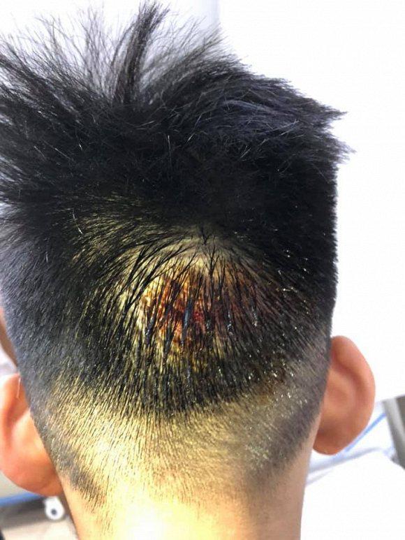 Người mẫu Hạ Vy bàng hoàng khi hai con nhỏ bị ô tô tông chấn thương rồi bỏ chạy-3