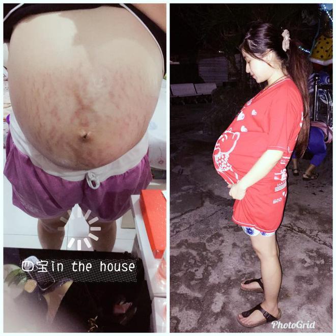 Mẹ trẻ gây ám ảnh với bộ ngực chảy xệ, da bụng rạn nứt tung tóe sau sinh-5