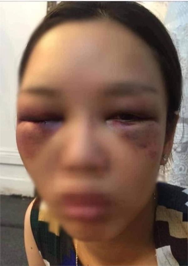 LỊCH SỬ LẶP LẠI: Dân tình đau đầu đoán nguyên nhân cô dâu mặt nặng mày nhẹ, phũ phàng đẩy chú rể khi bị hôn-3