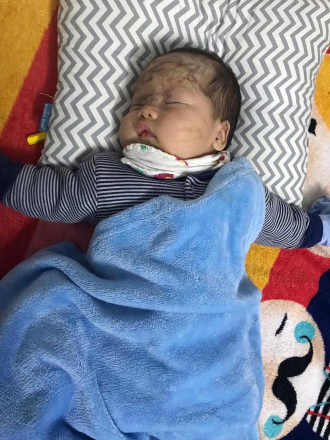 Bóc phốt em gái dùng hết cả hộp kem trộn để tắm trắng, cô chị khiến người xem hú hồn khi nhìn thành quả-5