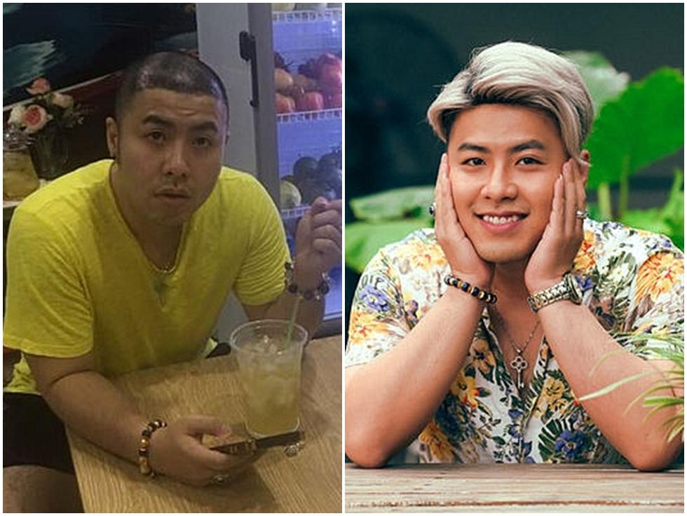 Cận cảnh quá trình phẫu thuật thẩm mỹ từ cấy tóc đến hút mỡ tốn đến 300 triệu để lấy lại vóc dáng của Akira Phan-5