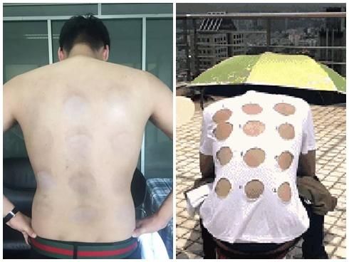 Chàng trai có tâm nhất quả đất, không ngần ngại phơi mình thử 12 loại kem chống nắng để review