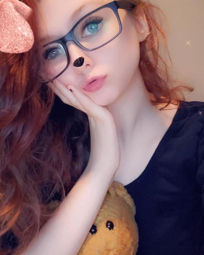 Người trẻ đổ xô đi phẫu thuật để giống ảnh sống ảo trên mạng xã hội-3