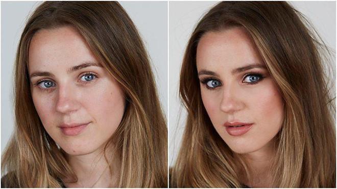 Người trẻ đổ xô đi phẫu thuật để giống ảnh sống ảo trên mạng xã hội-1