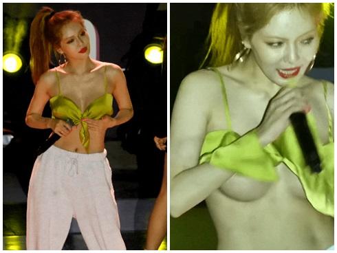 Hyuna lộ bằng chứng phẫu thuật vòng một sau sự cố lộ hàng-3