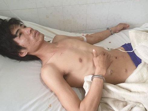 Vừa mổ xong, trốn viện đi… cướp!