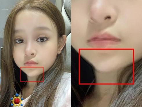 Huyền Baby gây sốt nhờ gương mặt như búp bê nhưng lại khiến người xem sợ hãi với chiếc cằm bị lẹm hẳn một góc