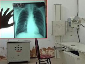 Bé gái nghi bị hiếp dâm trong phòng X-quang: Chụp chiếu tim, phổi nhưng bắt cởi cả quần lót.. Bé gái nghi bị hiếp dâm trong phòng X-quang: Chụp chiếu tim, phổi nhưng bắt cởi cả quần lót..