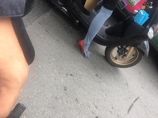 Giật mình vì đôi chân quái dị của người phụ nữ trên đường phố, nhưng sự thật là...-1