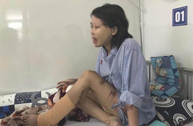 Cô gái xinh đẹp bị chồng sắp cưới tạt axit: Tôi trắng tay rồi-2