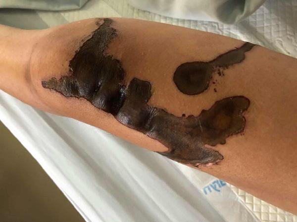 Bố mẹ phải giấu tất cả gương soi vì sợ tôi nghĩ quẩn-3