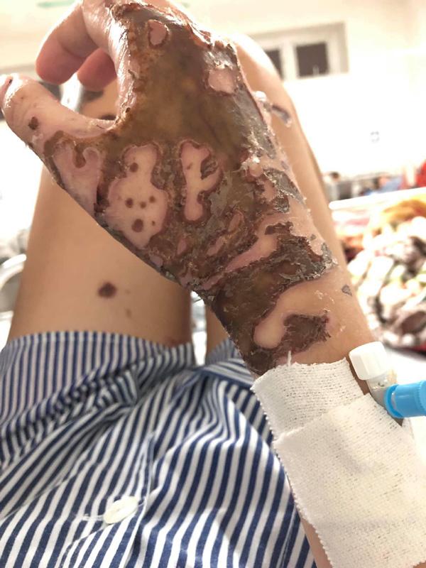 Bố mẹ phải giấu tất cả gương soi vì sợ tôi nghĩ quẩn-4